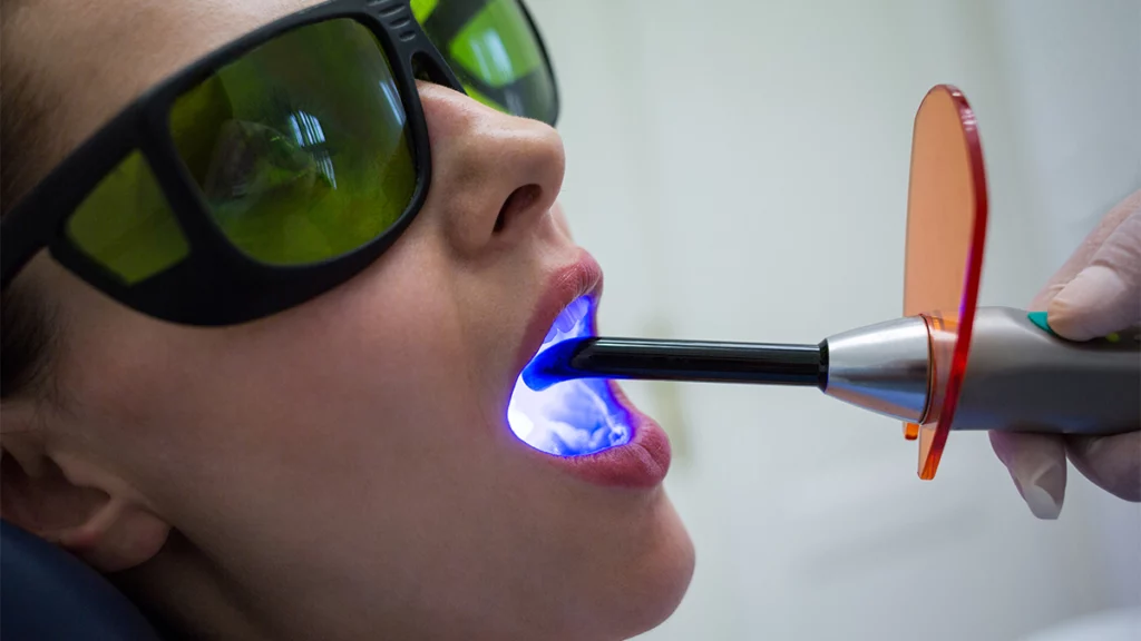 Tooth-Mounted Sensor